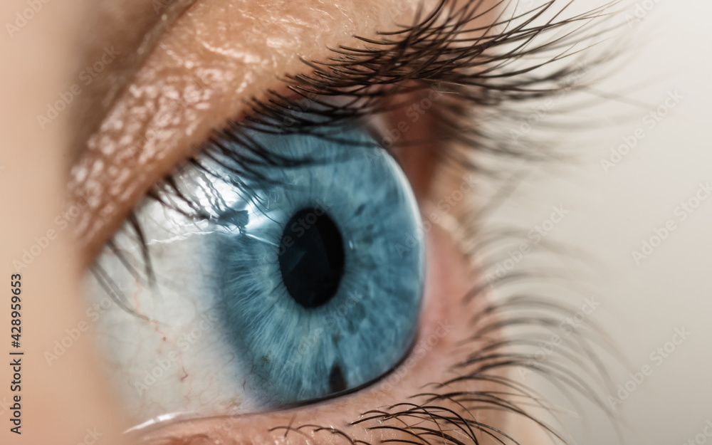 Optic neuritis